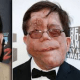Actor Adam Pearson