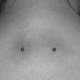 Nape