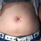 Multi-navel
