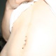Double navel