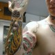Subdermal Implant