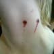 Fang marks