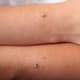 Wrist dermal piercing