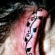 positioned on the outer side of the lobe