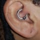 My daith piercing when it first started to become infected—you can see the skin is red and swollen.