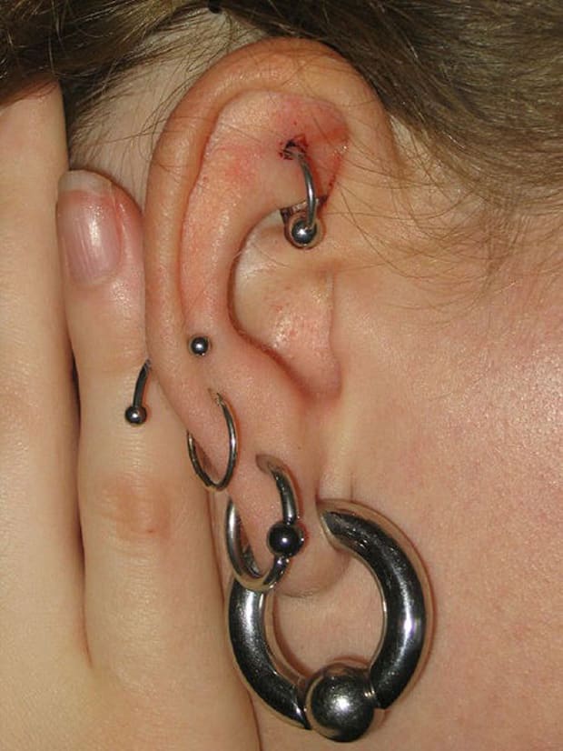 Infected Rook Piercing Symptoms Treating With Salt And H2ocean Aftercare Spray Hubpages