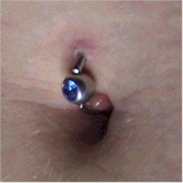 wrongly pierced belly button