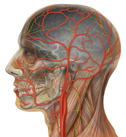 Temporal arteritis is an inflammation in the blood vessels, specifically those that supply your head with blood.