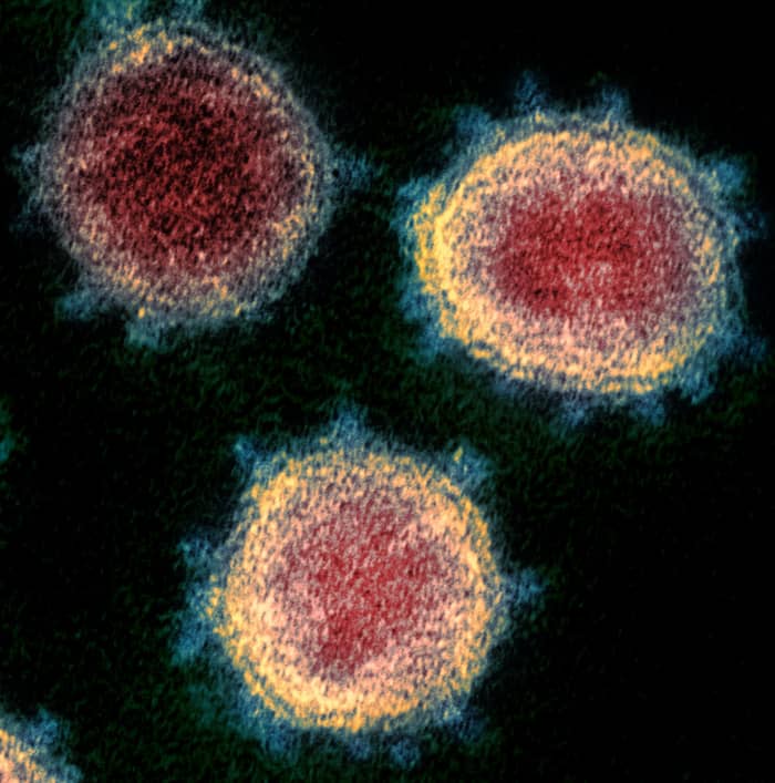 What SARS-CoV-2 looks like when viewed through a transmission electron microscope (TEM). This virus is responsible for causing COVID-19. Coronaviruses get their name from the “corona” or “crown” of spikes that line the edges of the viral particle.