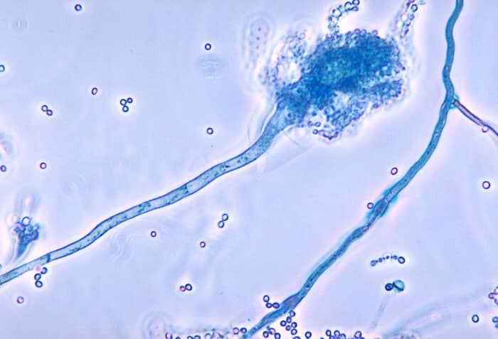An Aspergillus fumigatus conidiophore bearing spores known as conidia