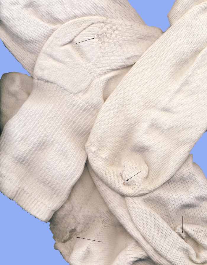 Are socks with holes really lost causes?