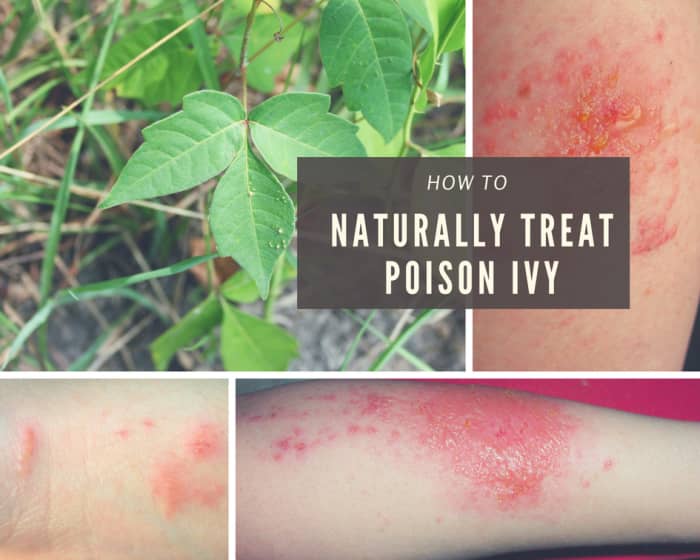Here is what a poison ivy plant looks like as well as what a rash may look like.