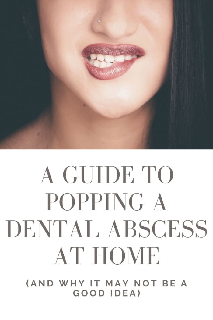 How to Pop a Dental Abscess by Yourself (and Why It's Risky) RemedyGrove