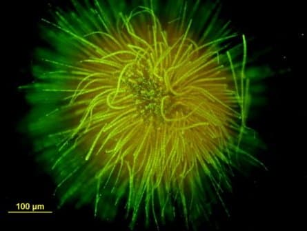 A close up of Cyanobacteria courtesy of the United States Geographic Survey - photo by Barry H. Rosen, USGS