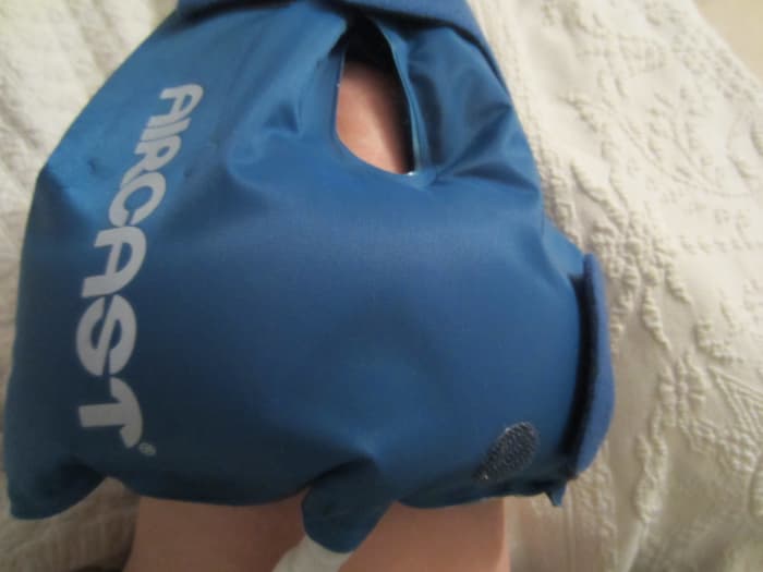 My own personal favorite icing method is something I received in the hospital after one of my surgeries: it's called a cryo cuff with a cooler. This is a photo of the cryo cuff on my knee.