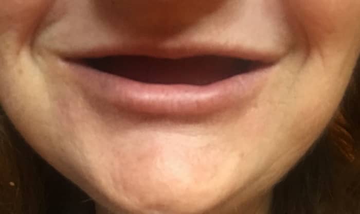 Getting dentures for the first time can be a scary thought. I was intimidated and had no idea what I was in store for.
