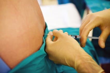 The skin of your back will be numbed before administration of the spinal anesthetic.