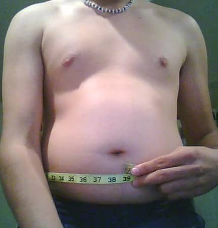 Bloated Stomach - This person clearly has blockage somewhere and has had for awhile. He could benefit from a good hydrocolonic.