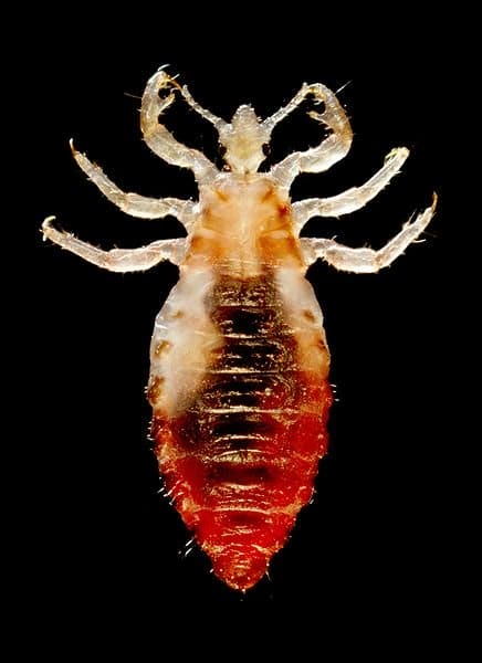 Male body louse. The dark mass in the middle of the body is its last meal: blood.