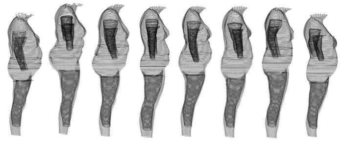Each of these women have a BMI of 30, yet as you can see, they each are shaped differently, some appear overweight, others look more average, yet all are classified as obese.
