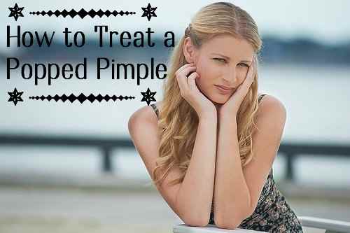 how-to-treat-a-bleeding-open-wound-of-a-popped-pimple