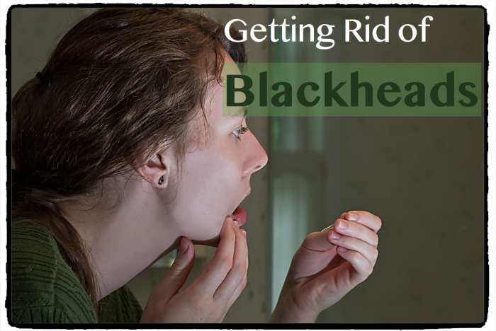 Blackheads are stubborn, but there are simple and effective ways to remove them from your face.