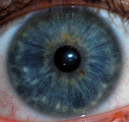 What to know about getting your eyes dilated