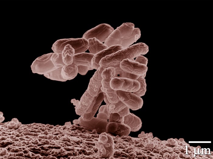 A cluster of E. coli cells