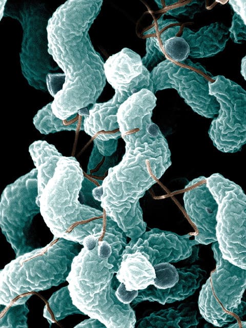 Campylobacter (colourized)