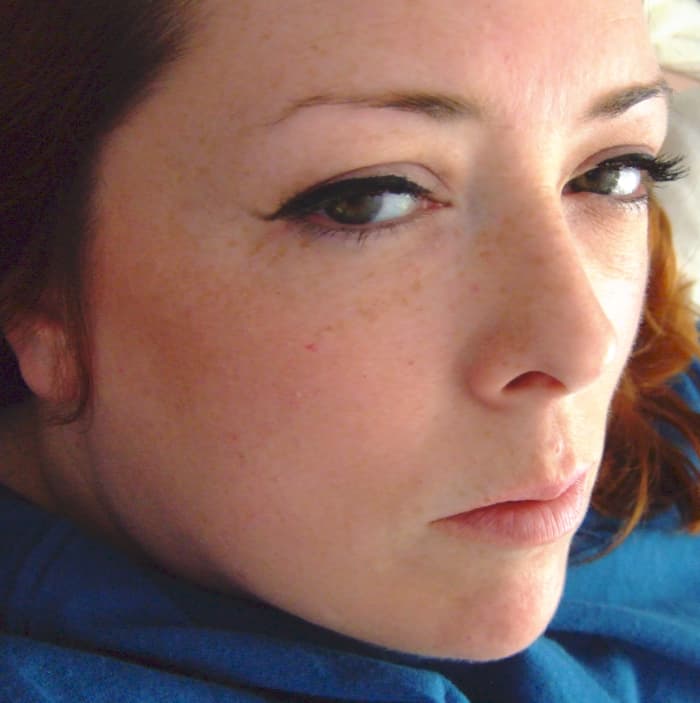 could-a-concussion-have-caused-my-bipolar-disorder-hubpages