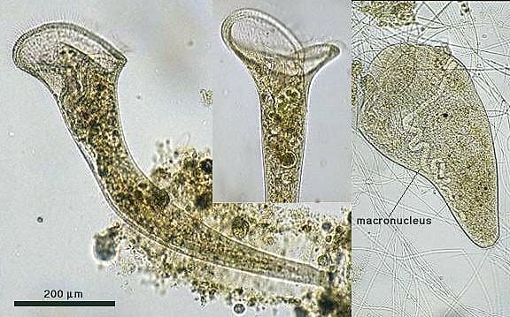 A composite of Stentor roeselii photos