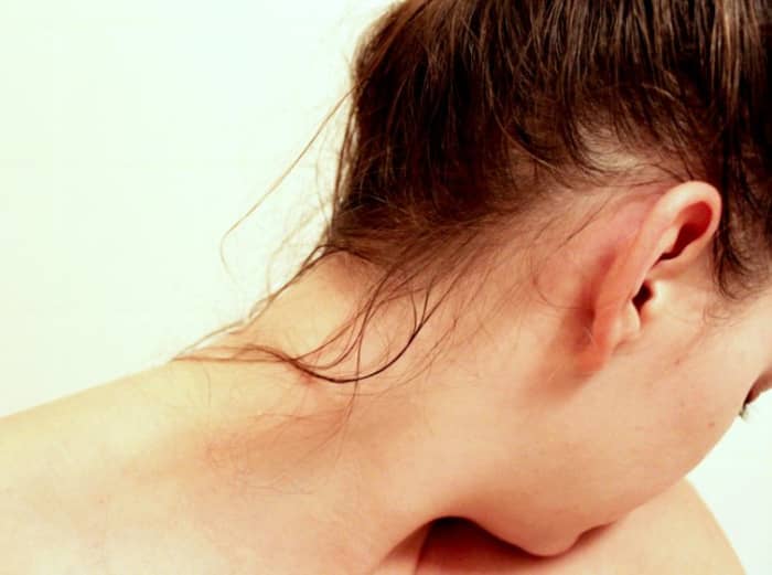 Greasy hair is a very common condition, but there are easy ways to address it.