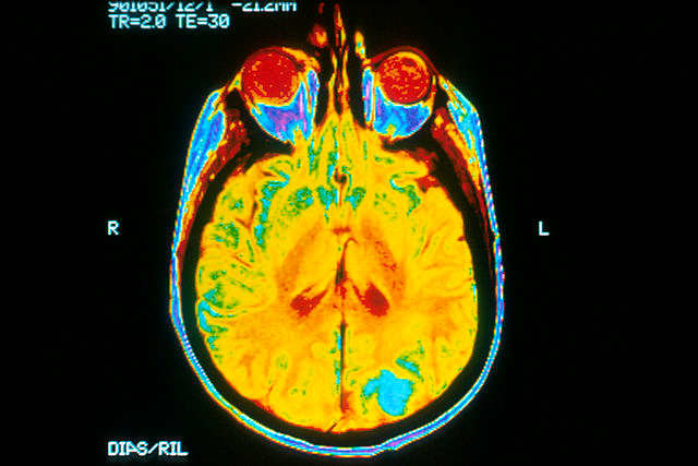 A single image of a human brain using a magnetic resonance imaging (MRI) machine.