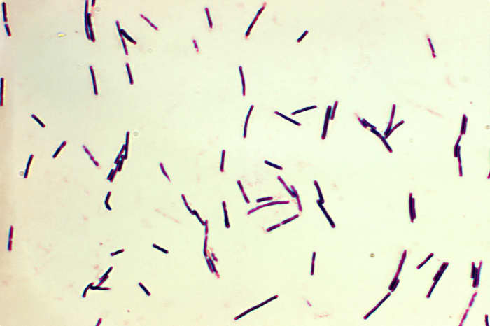 Clostridium perfringens cells