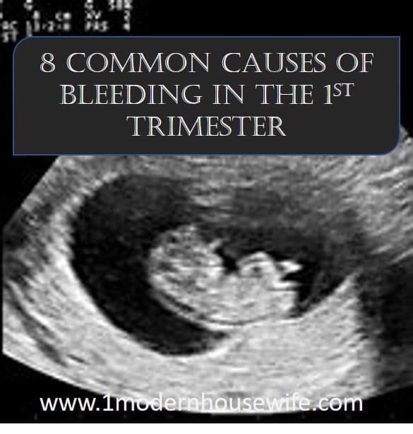 pdf-first-trimester-bleeding-evaluation-and-management-semantic