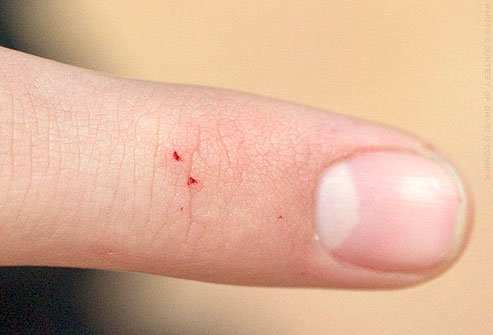 Should I Be Afraid of Wolf Spiders? - Dengarden