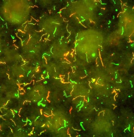 A swarm of Borrelia in their spiral form.