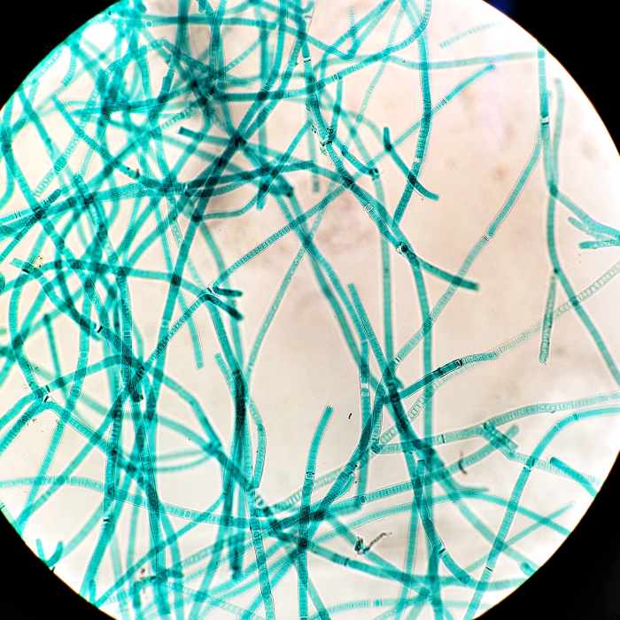 What Are Cyanobacteria, and How Are They Similar or Different From