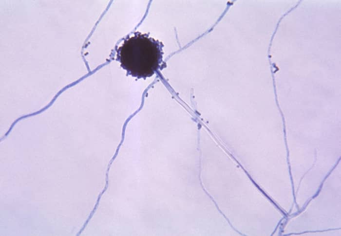 Aspergillus niger can be both helpful and harmful.