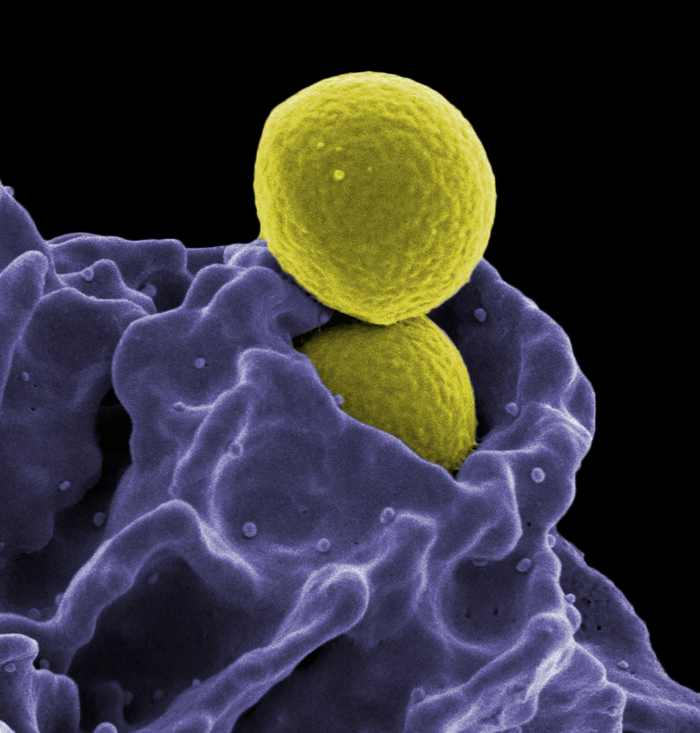 Neutrophils protect us from fungal spores and bacteria. In this photo, a neutrophil is ingesting an MRSA bacterium. Both the neutrophil and the bacteria are colorized.