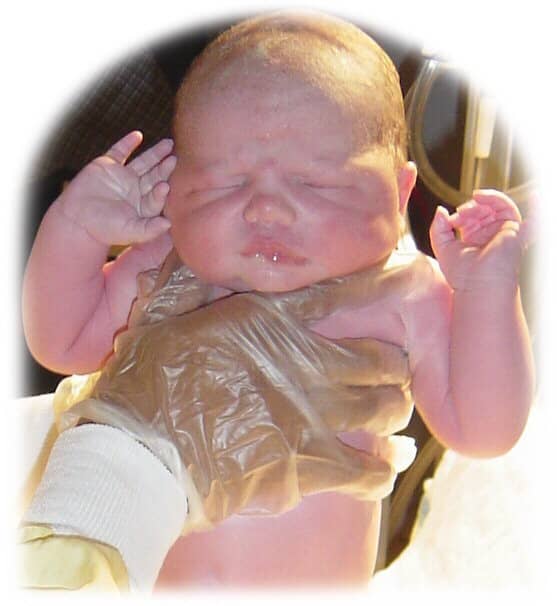 All newborn babies should be monitored for signs of jaundice
