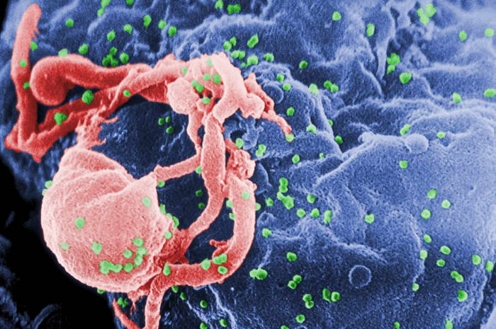 A colourized photo of the HIV-1 virus (green) budding from a type of white blood cell called a lymphocyte (blue).