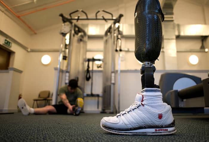 Because of the uncanny valley, roboticist Mashahiro Mori recommends that prostheses be made to look obviously artificial.