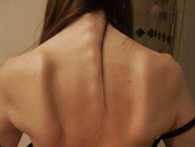 Anorexia causes a weakened immune system, weakened muscles, digestive problems, and neurological problems and enjoys the highest fatality rate of any psychiatric disorder.