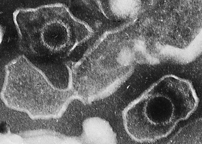 Two virions (virus particles) of the Epstein-Barr virus; each virion is round and is loosely surrounded by a protective envelope