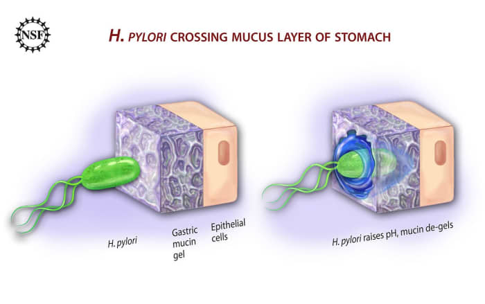 Helicobacter pylori action in the stomach