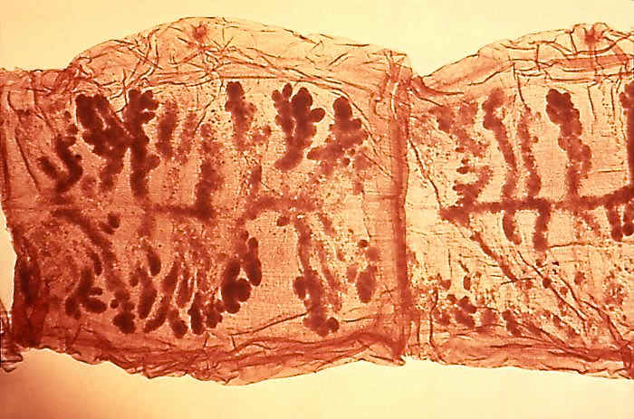 Pork tapeworm proglottids with a stain added