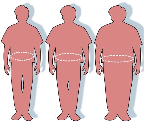 Abdominal obesity is the most serious type with respect to health.