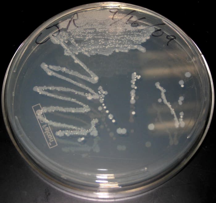 A culture dish containing a number of bacterial colonies resulting from a random sample swab. This is used to illustrate the concept of contracting diseases from snakes, notably Salmonella bacteria (which are commonly associated with animal feces).