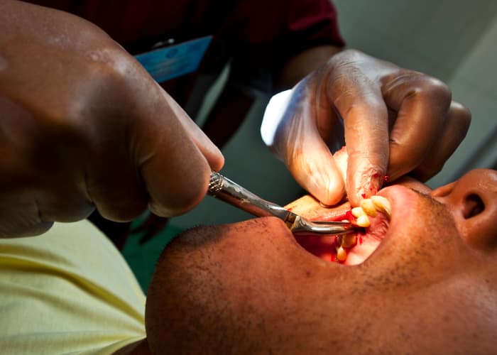 A dentist conducts an oral extraction. Seeing this should make you brush and floss better.